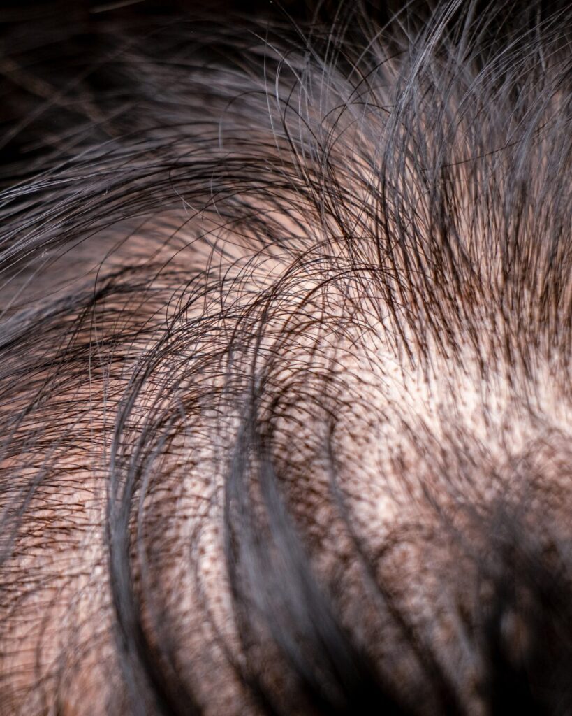 masterclass trichologie fonctionnelle